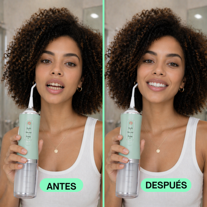 Irrigador Bucal Eléctrico Portátil
